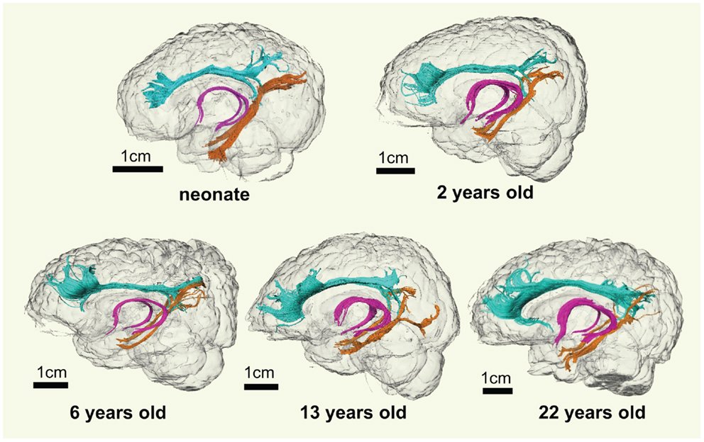 Visualizing Words: The Brain’s Inner Canvas (image credits: wikimedia)