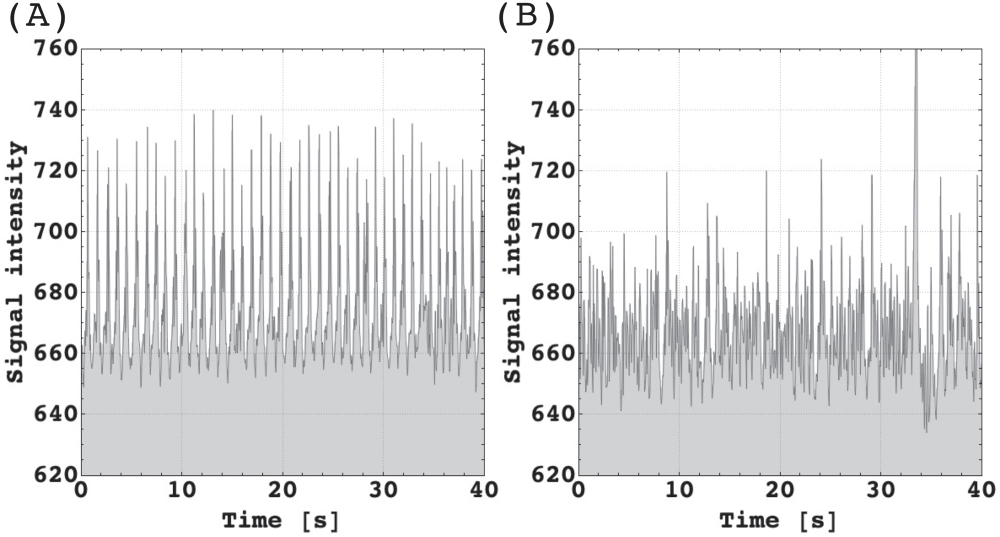 Brain Waves: The Secret Language of Sleep (image credits: wikimedia)