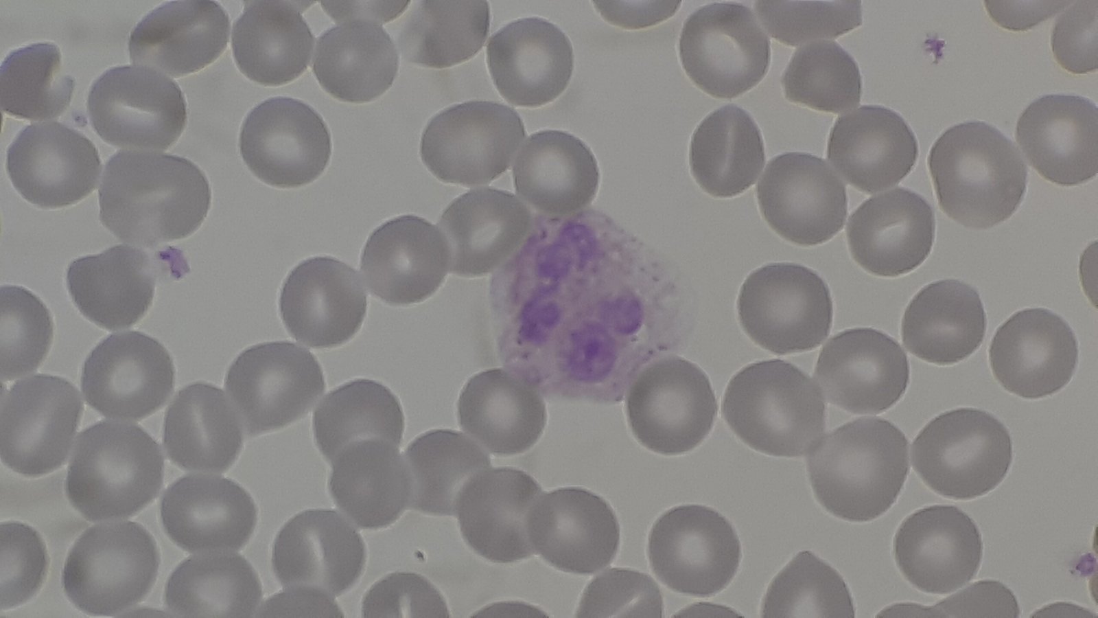 White Blood Cells: The Unsung Heroes (image credits: wikimedia)