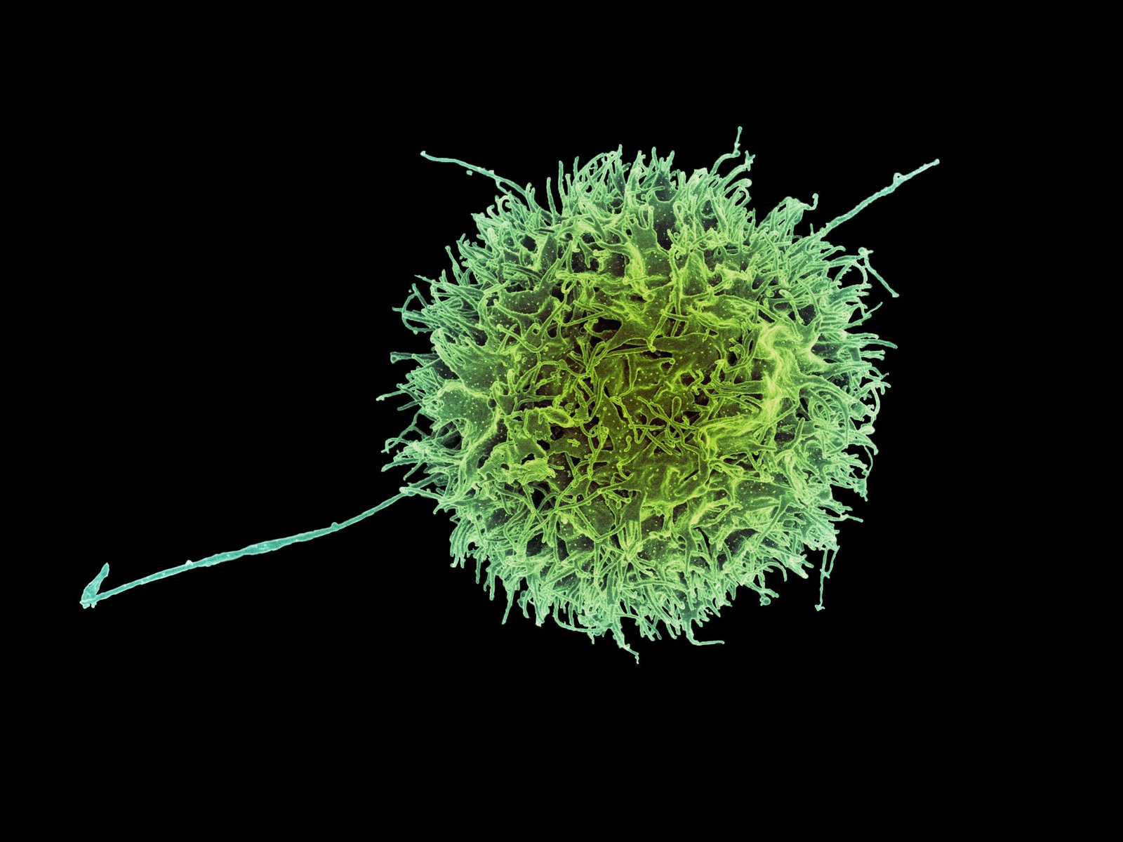 Natural Killer Cells: The First Responders (image credits: wikimedia)
