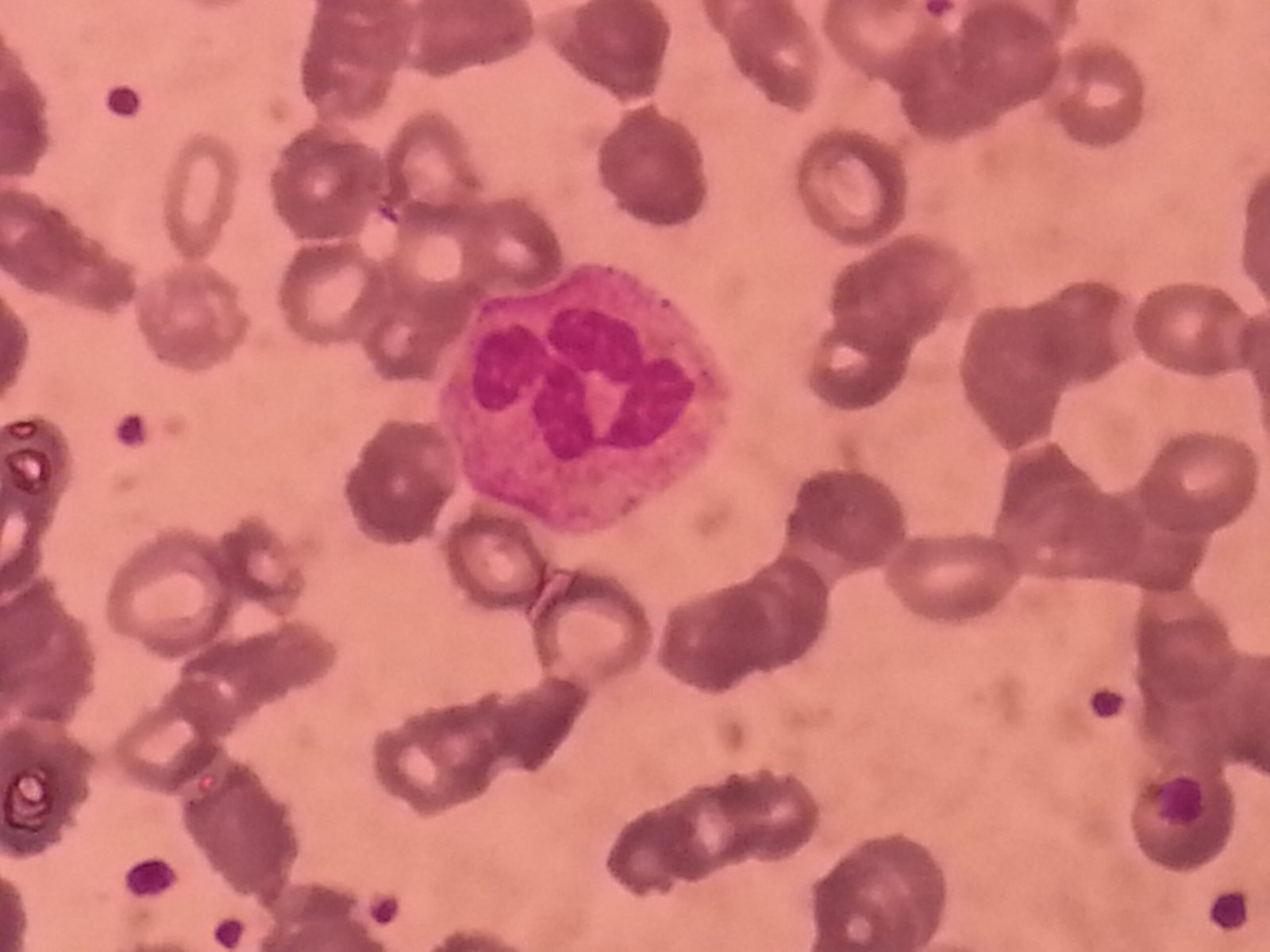 Blood Types: More Than Just Letters (image credits: wikimedia)