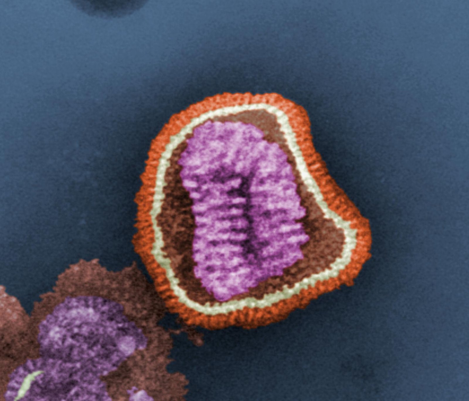 The Ever-Changing Face of Influenza (image credits: wikimedia)