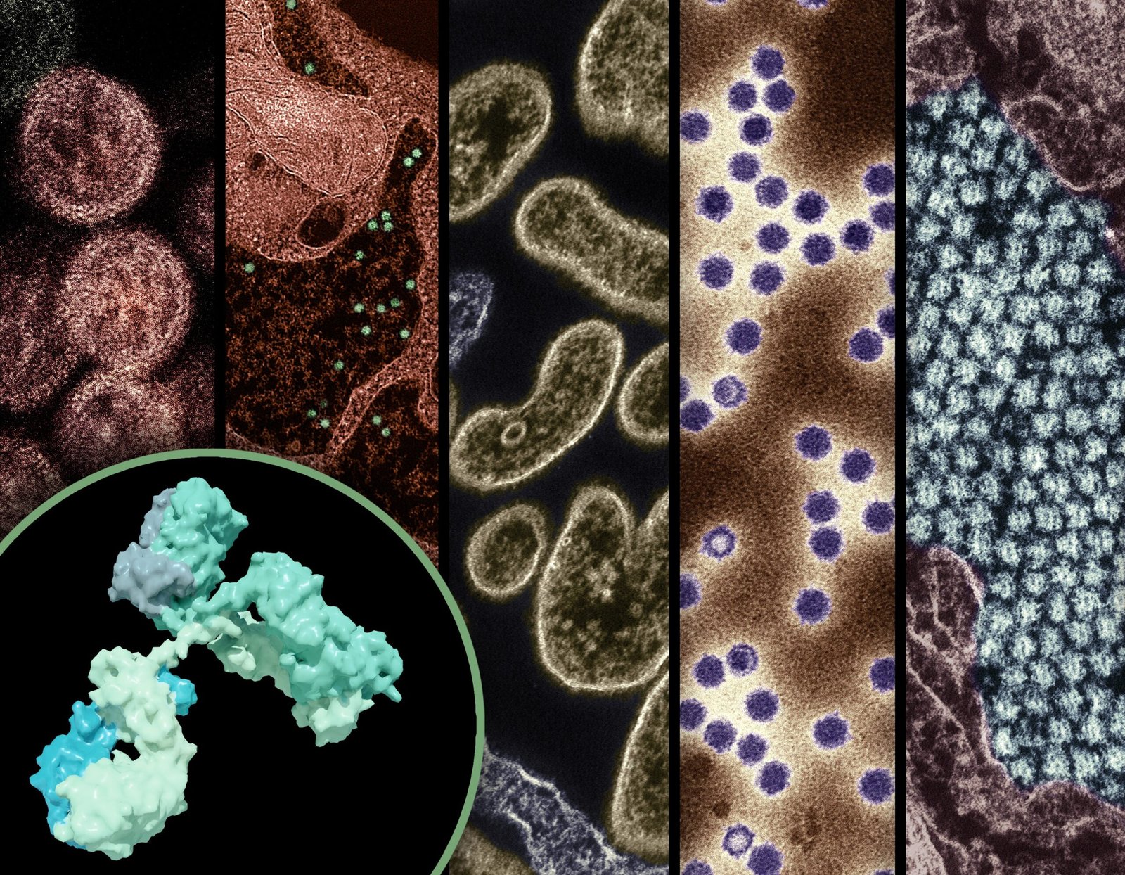 The Arrival of a Deadly Pandemic: COVID-19 Changes Everything (image credits: wikimedia)