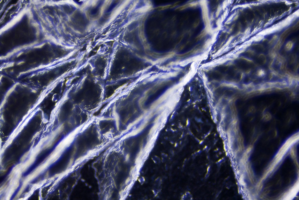 Dead Skin in Darkfield. 