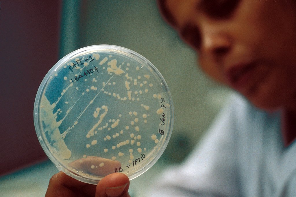 Bacteria sample