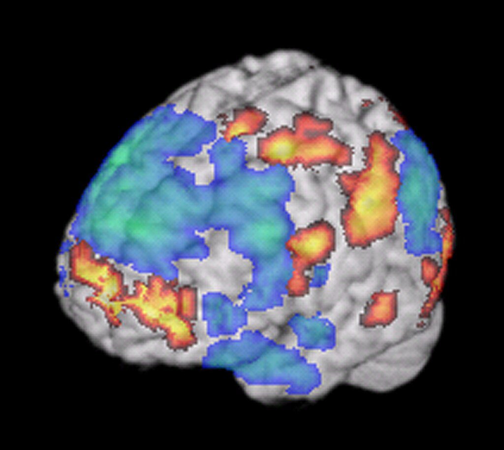What If You Could See With Your Brain? The Astonishing Power of Human Echolocation