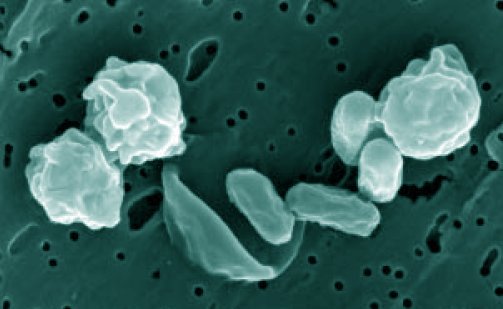 The Unlikely Heroes: Meet the Radiation-Eating Bacteria (image credits: wikimedia)