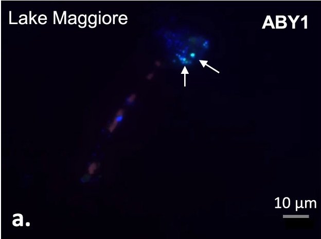 What’s Next for Radiation-Eating Bacteria? (image credits: wikimedia)
