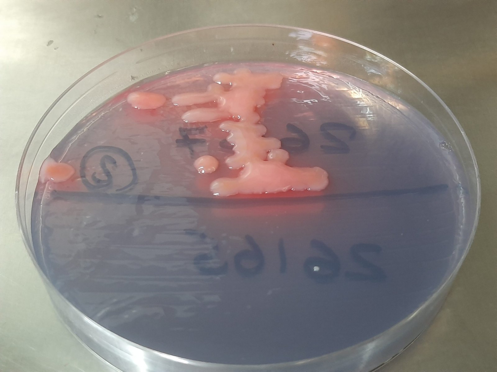 What Makes Superbugs So Terrifying? (image credits: wikimedia)