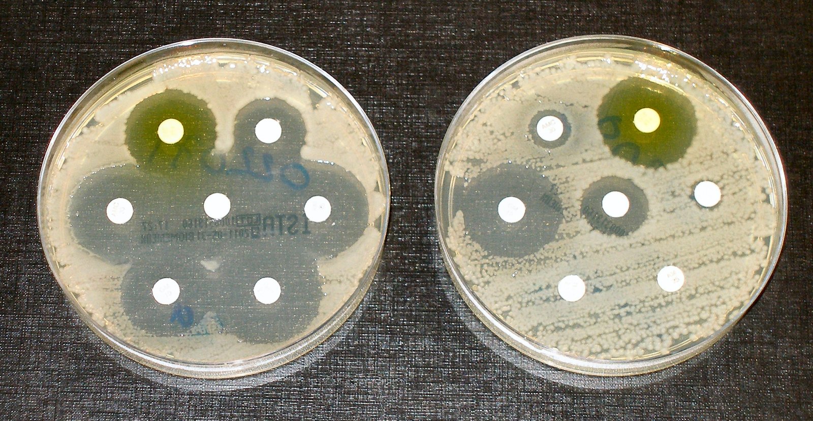 Superbugs: The Unseen Threat (image credits: wikimedia)