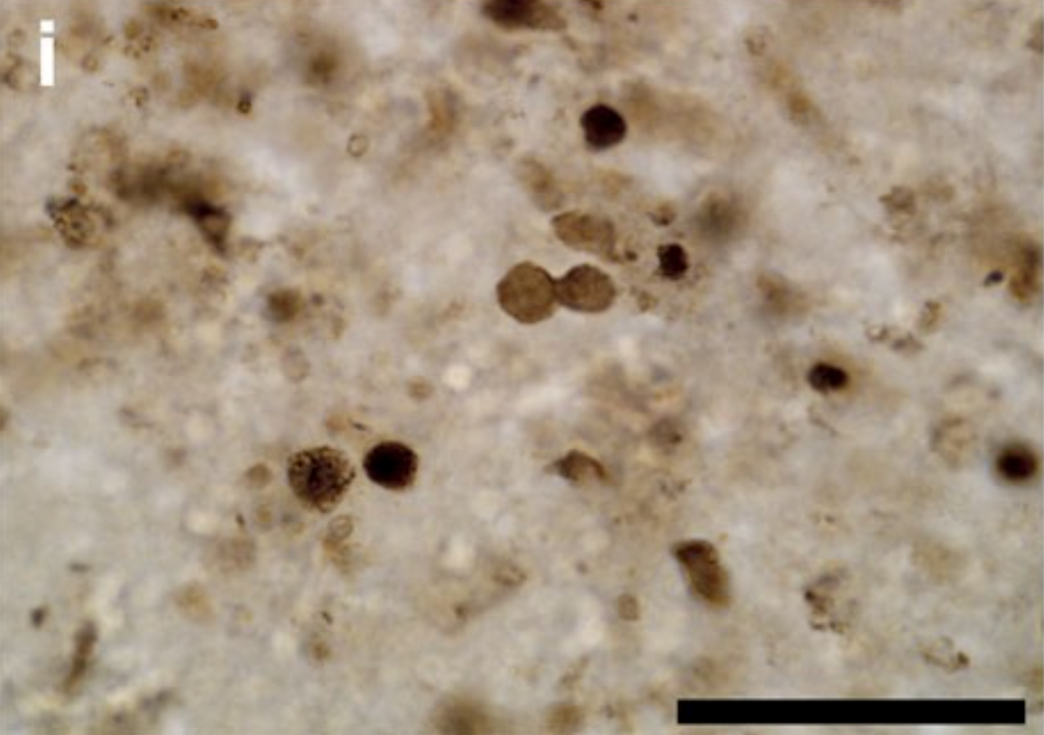 Microscopic Marvels: Preserving Pollen and Spores (image credits: wikimedia)
