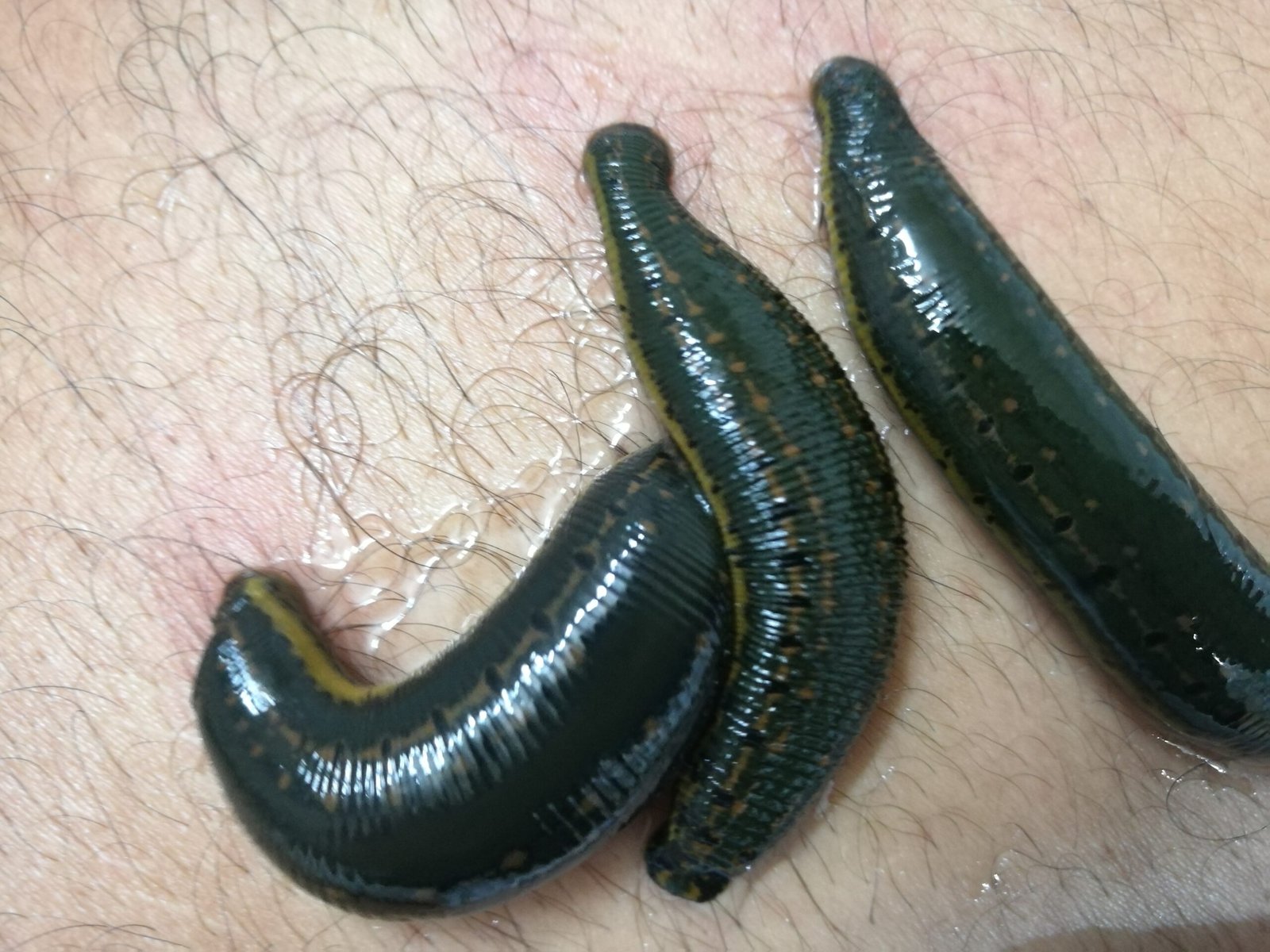 Leeches: Bloodsucking Miracle Workers (image credits: wikimedia)