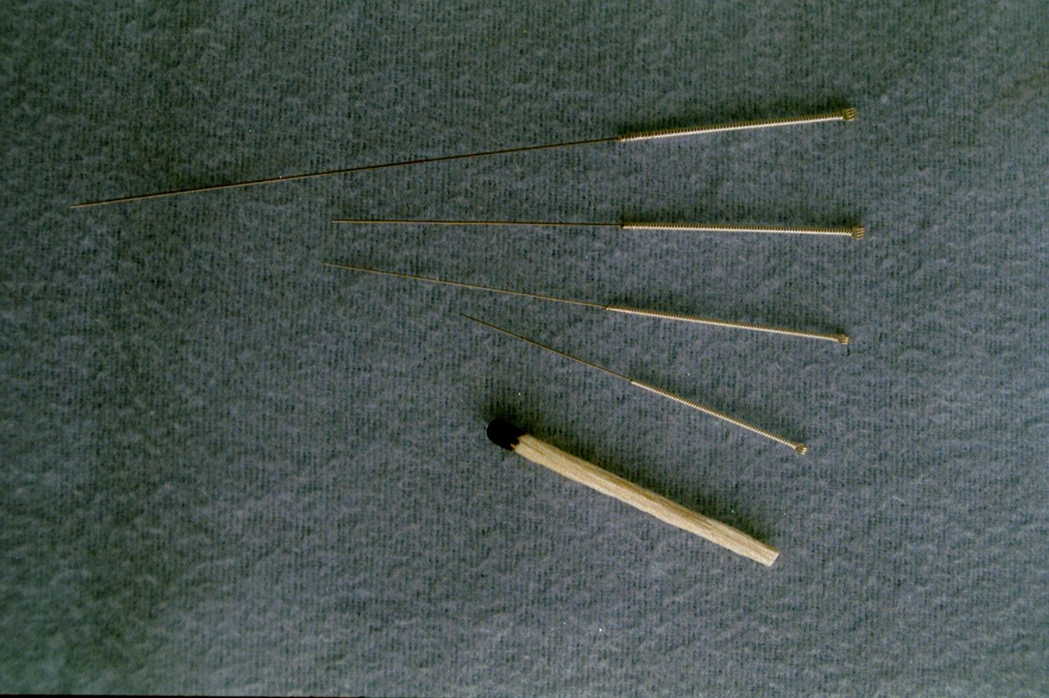 Acupuncture: Needles with Mysterious Power (image credits: wikimedia)