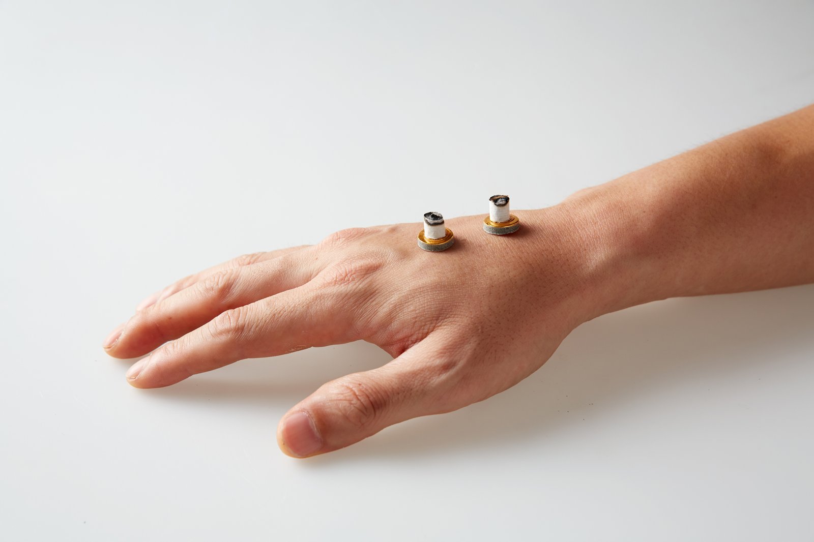 Moxibustion: Burning Herbs for Healing (image credits: wikimedia)