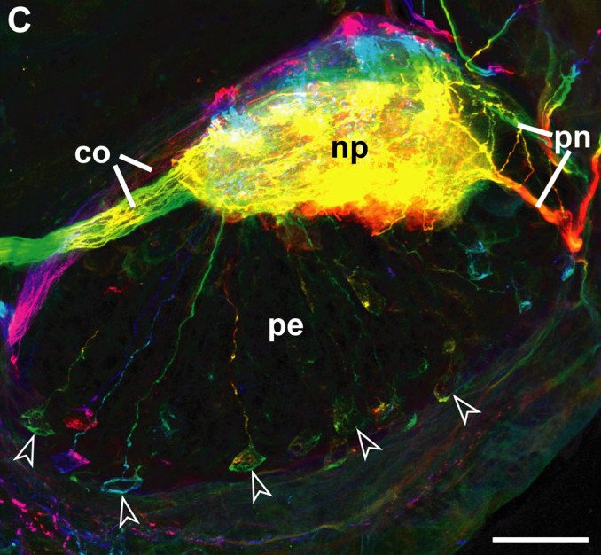 Electric Brains: How Worms Process Information (image credits: wikimedia)