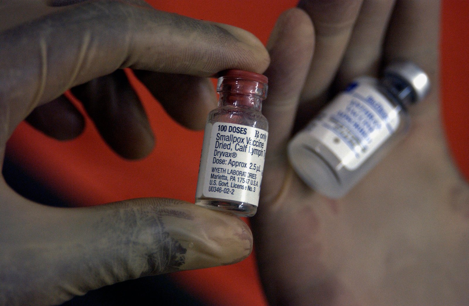 What the Battle Against Smallpox Means for Us Now (image credits: wikimedia)