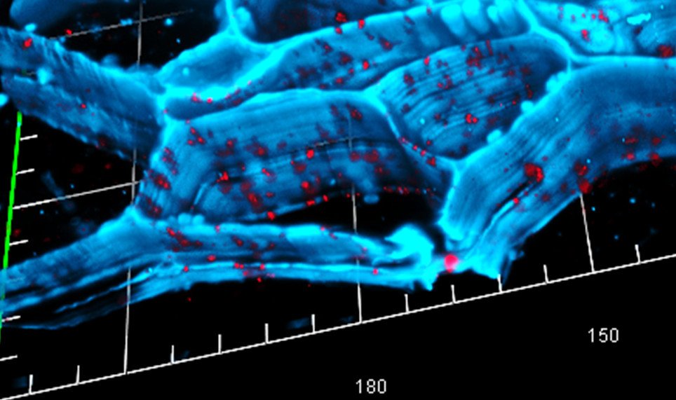 Advanced Imaging Reveals Bacterial Architecture (image credits: flickr)