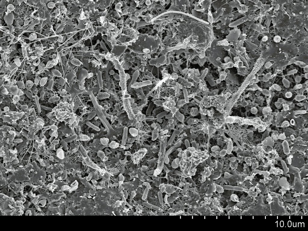 Biofilms: The Hidden Community (image credits: flickr)