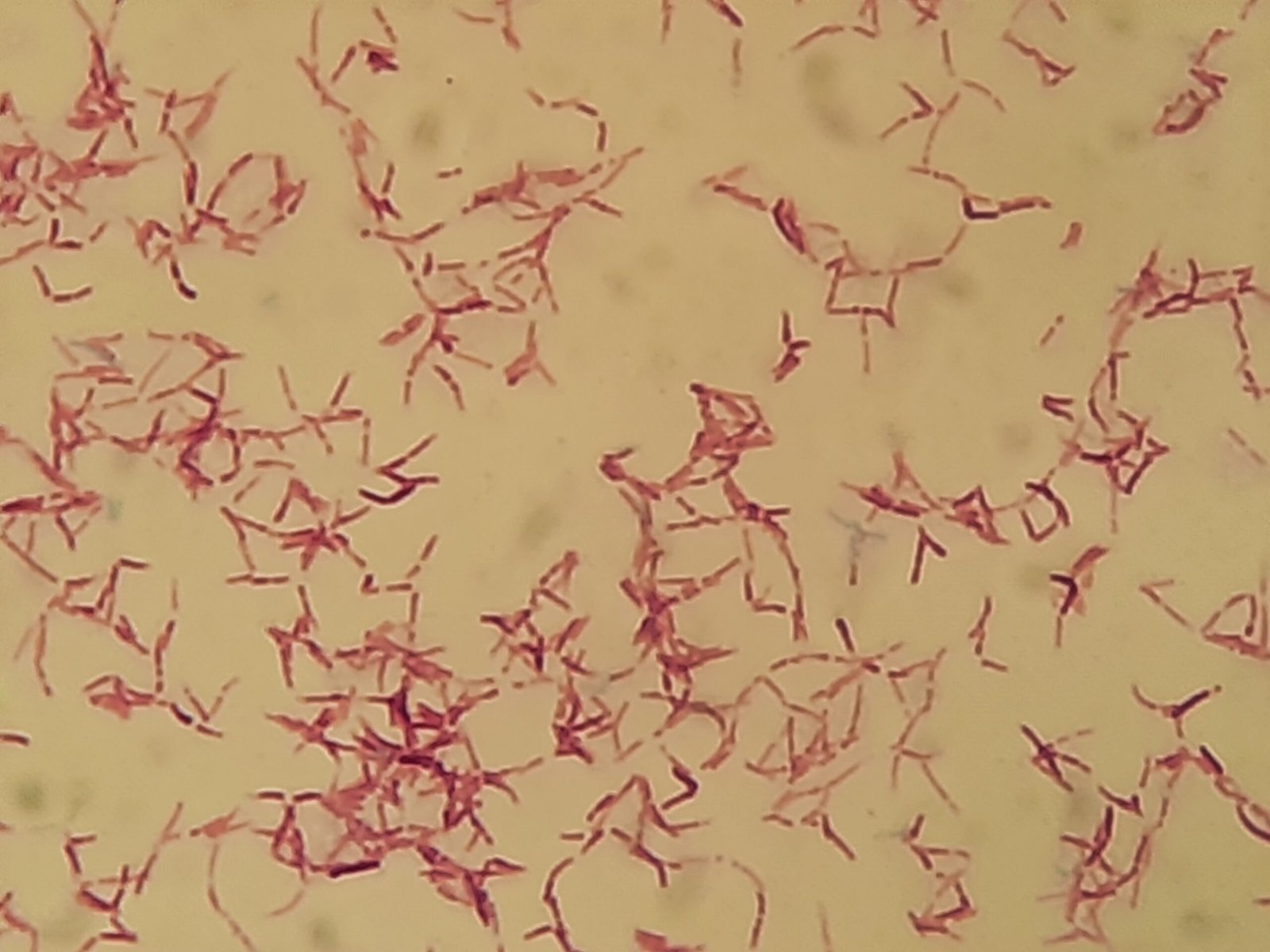 The Extreme Acidophiles (image credits: wikimedia)