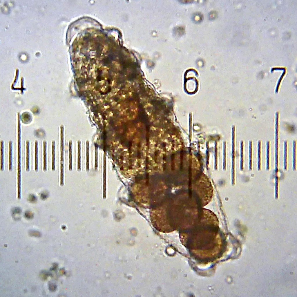 The Water Bears: Nature's Indestructible Astronauts (image credits: wikimedia)