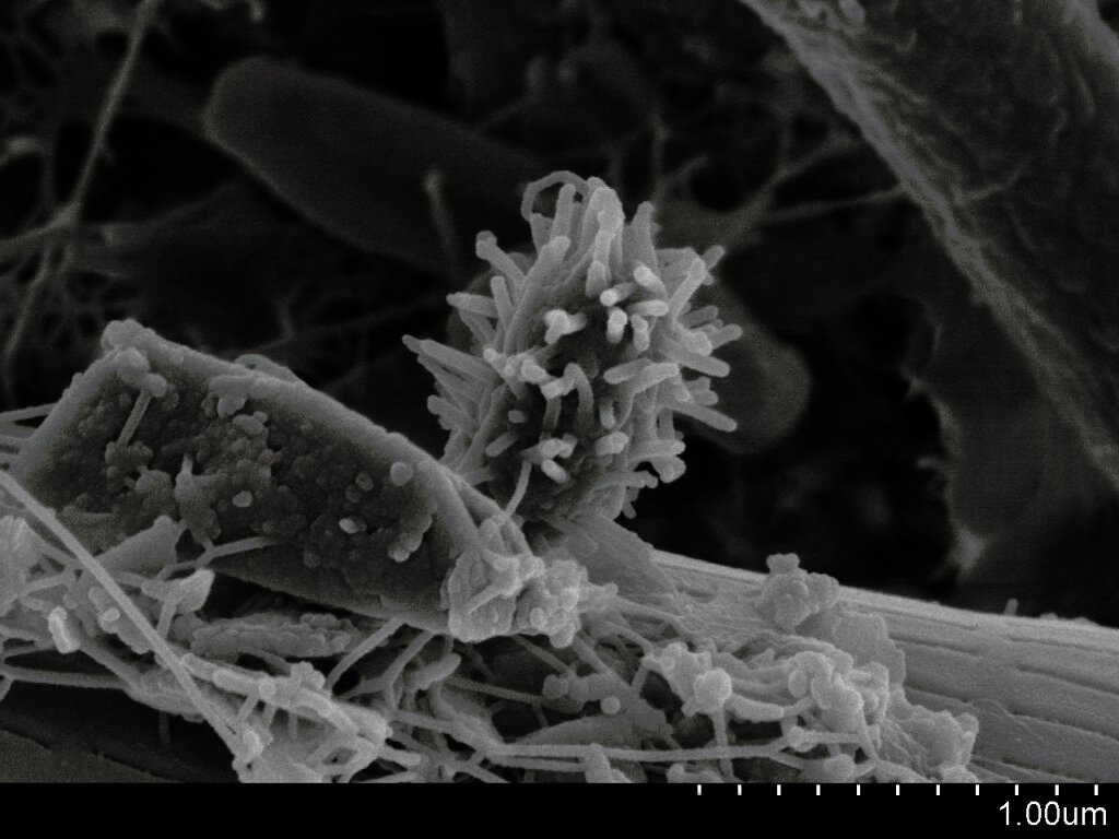 Teamwork Makes the Dream Work: Bacterial Communities (image credits: flickr)