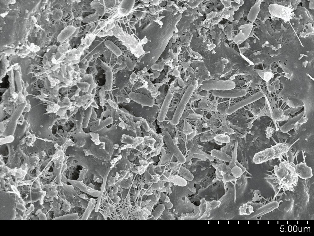 The Biofilm Builders: Creating Protective Communities (image credits: flickr)