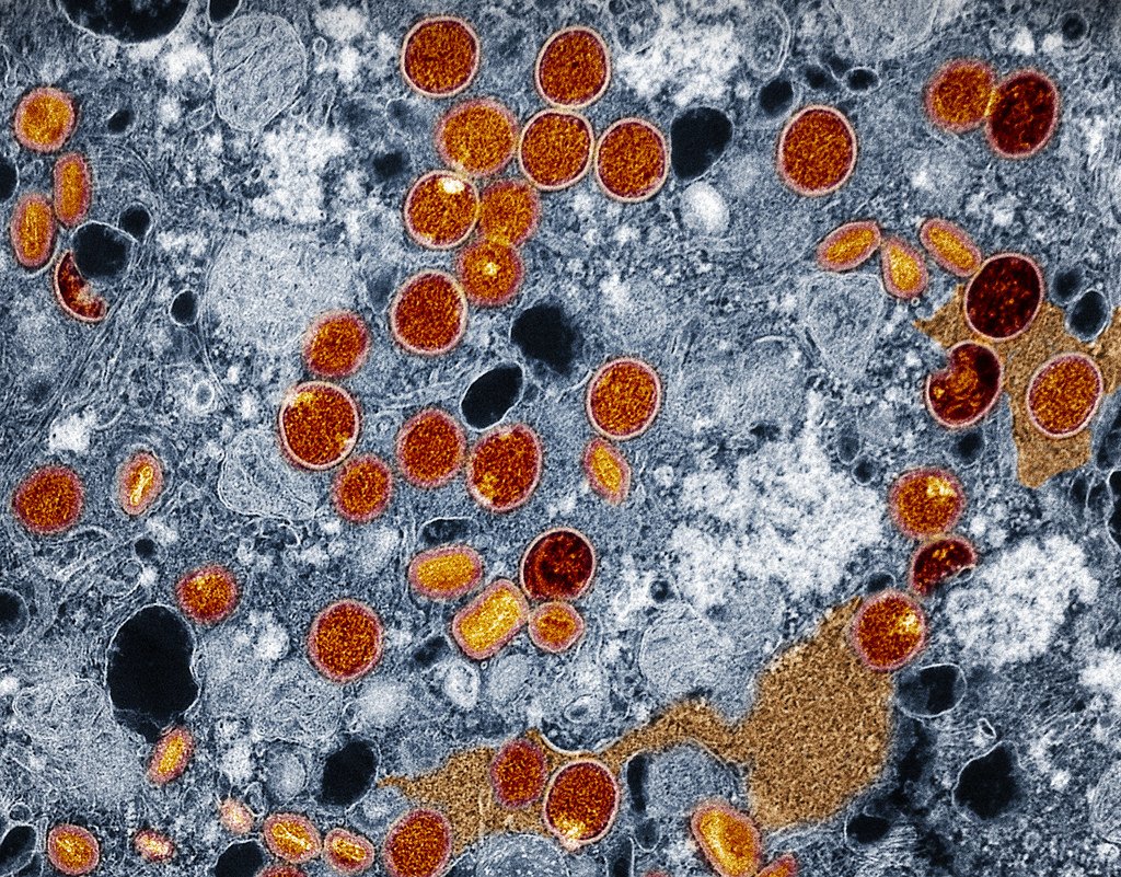 Assembly Line Madness (image credits: flickr)