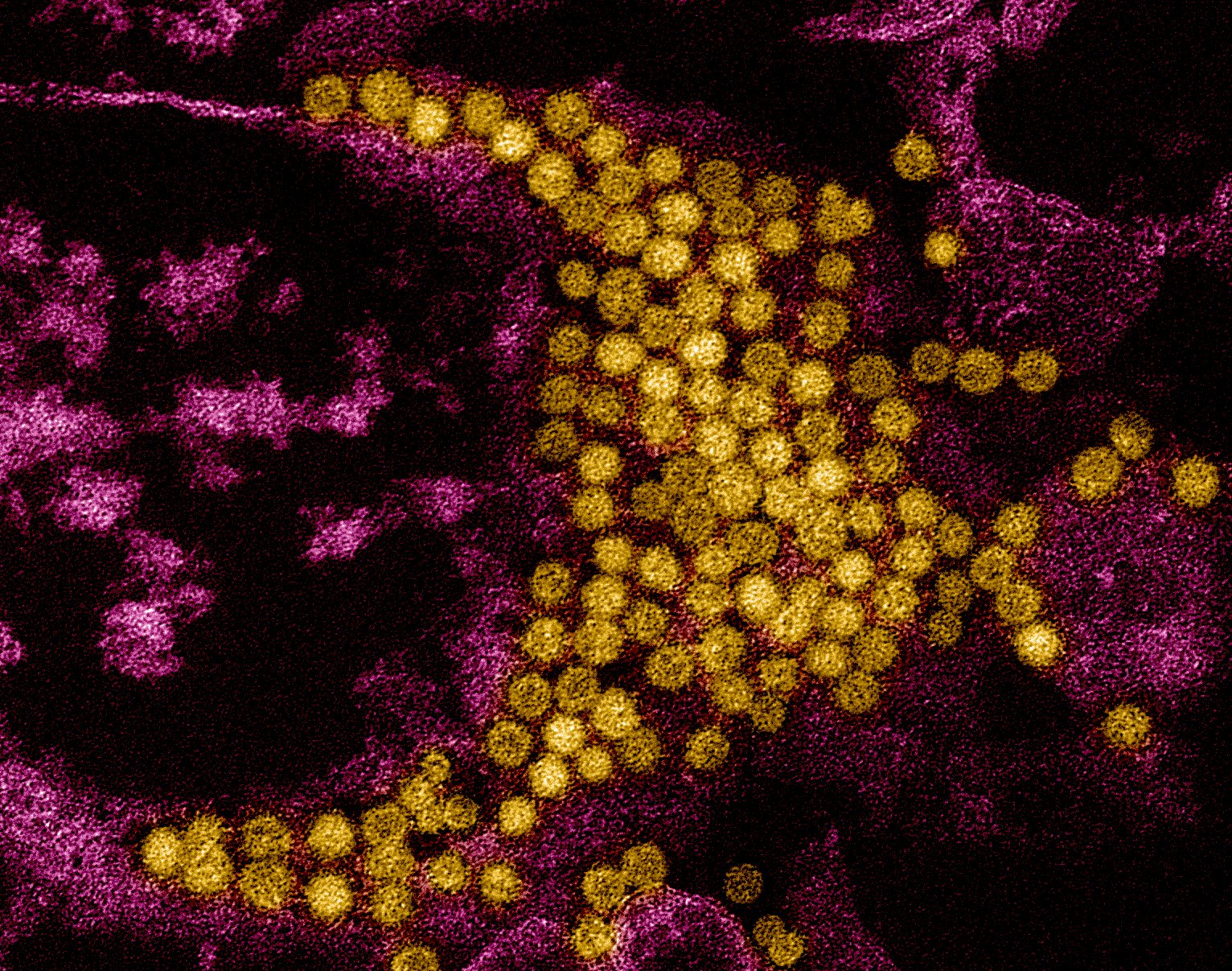 Viral Evolution and Adaptation (image credits: wikimedia)