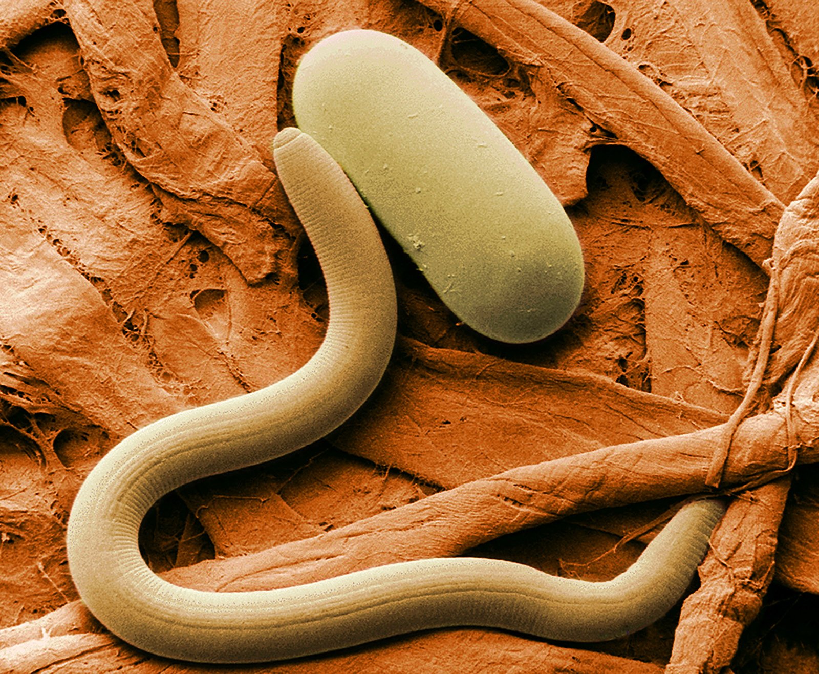 Why Reviving the Worm Matters (image credits: wikimedia)