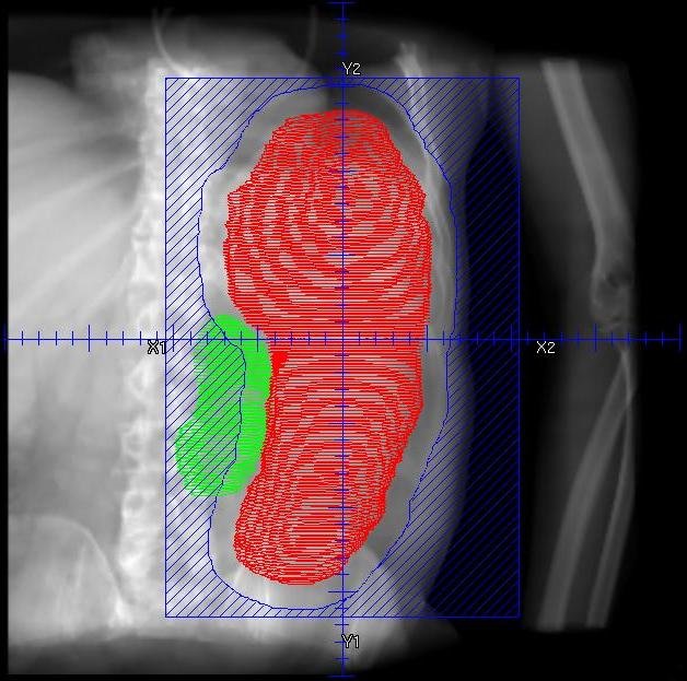 Tumor Microenvironment Manipulation Changes the Battlefield (image credits: wikimedia)