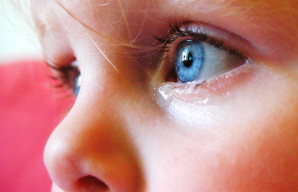 Excessive Tear Production