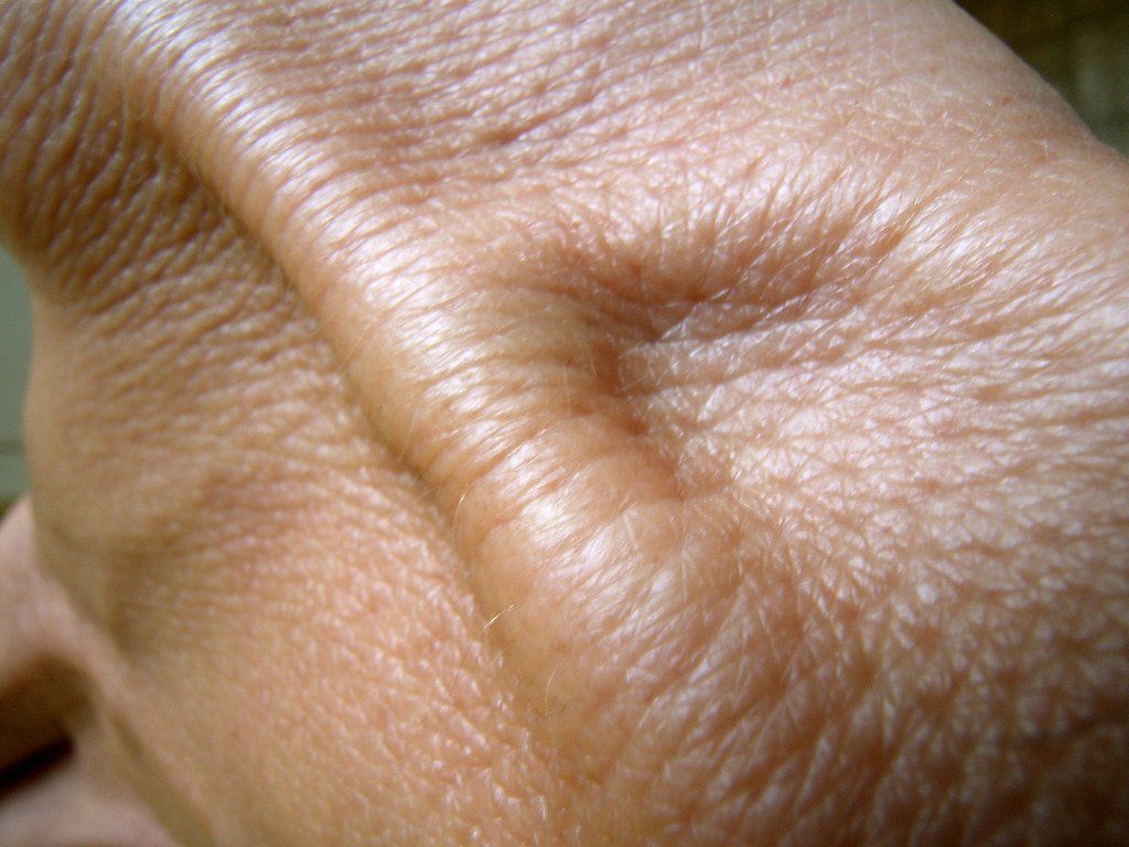 Environmental Factors: Pollution and Modern Skin Challenges (image credits: flickr)