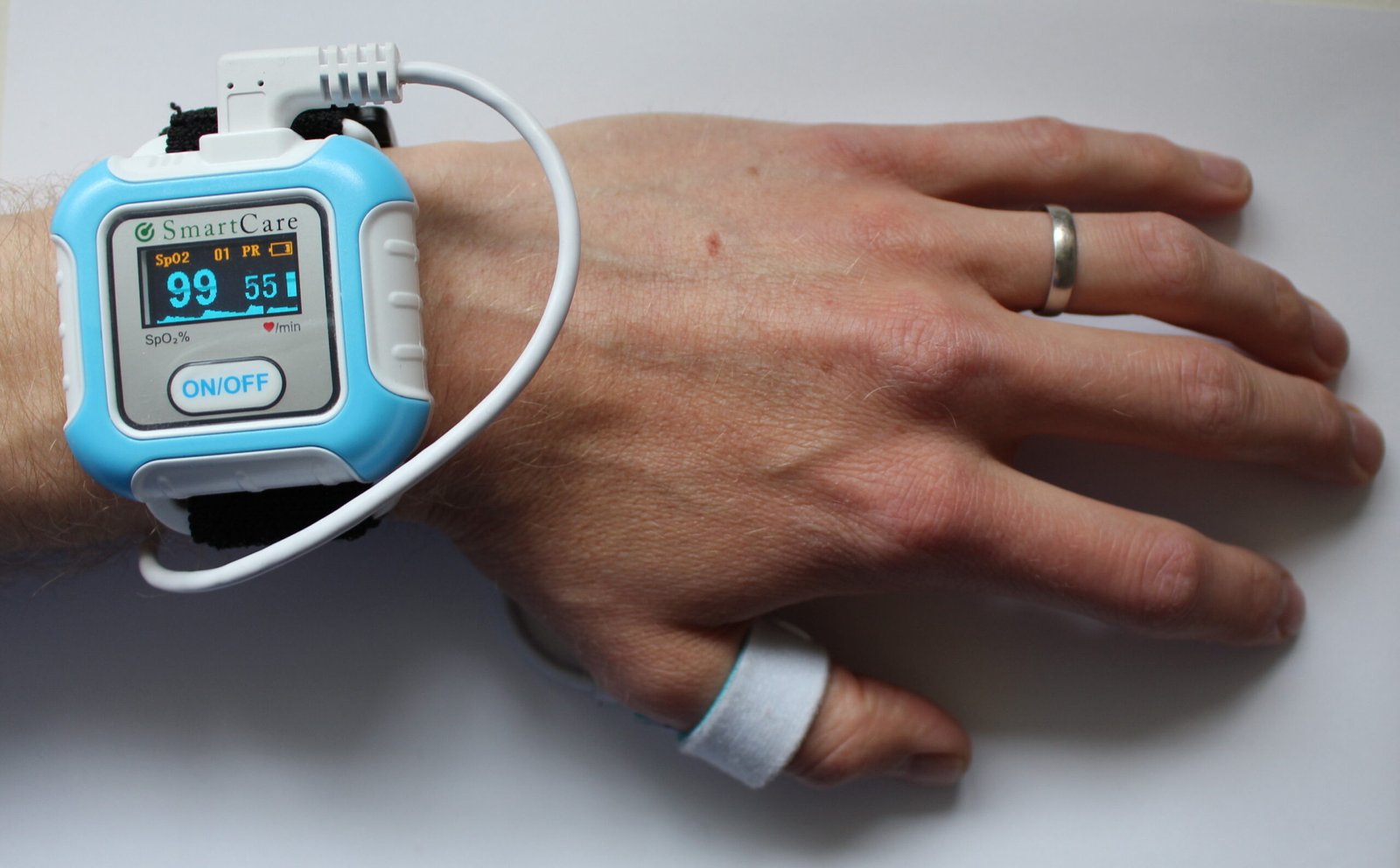 Technology and Innovation: Smart Skin Monitoring (image credits: wikimedia)
