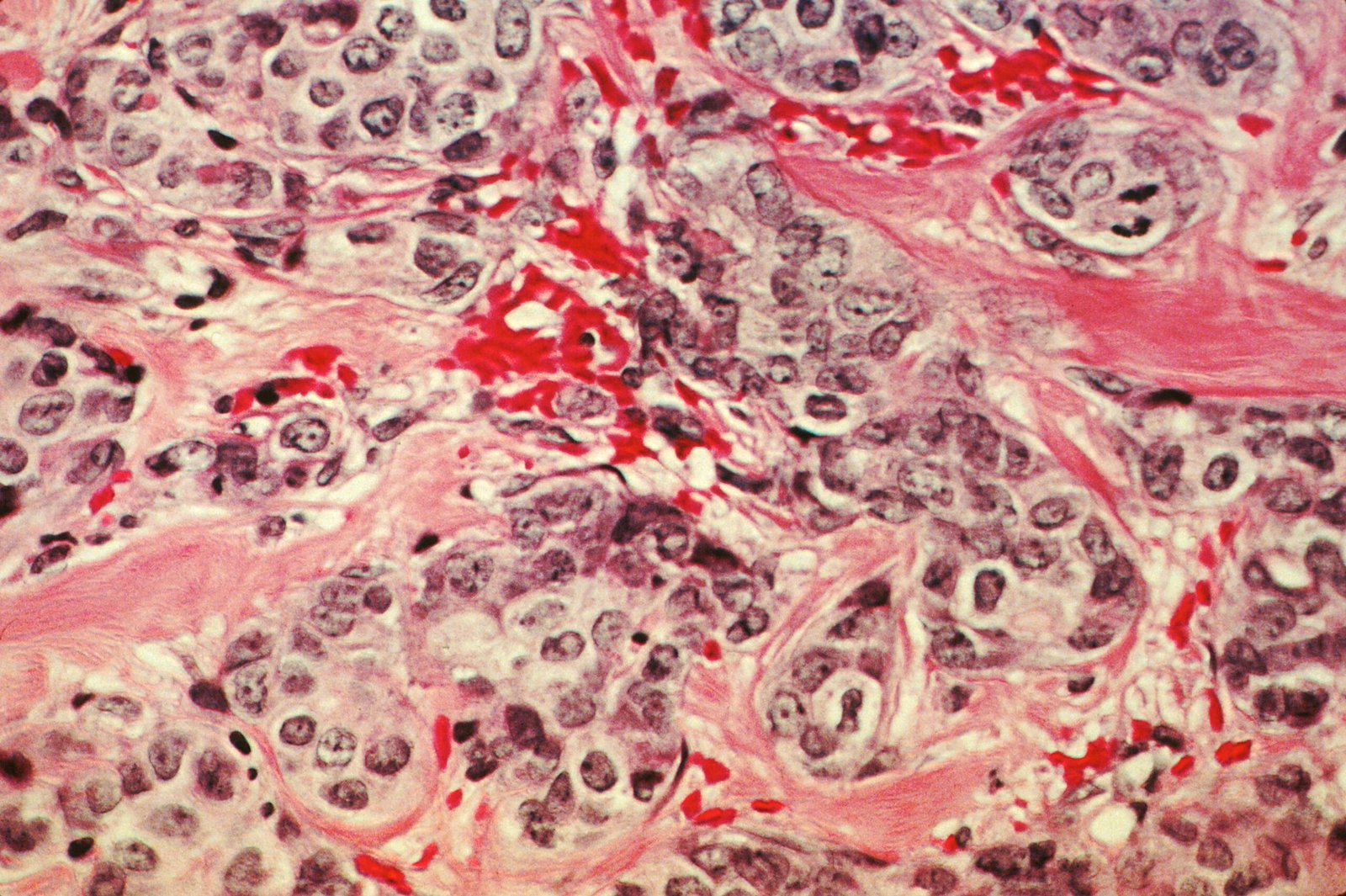 Understanding Cell Division and Cancer Growth (image credits: wikimedia)