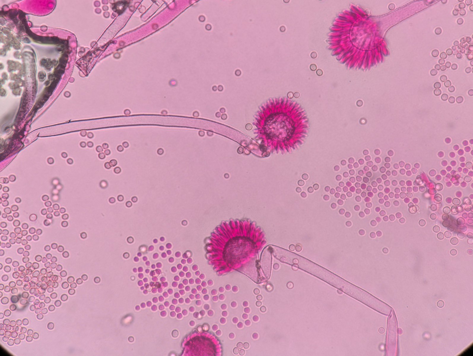 5 Microorganisms That Survive Conditions Humans Never Could