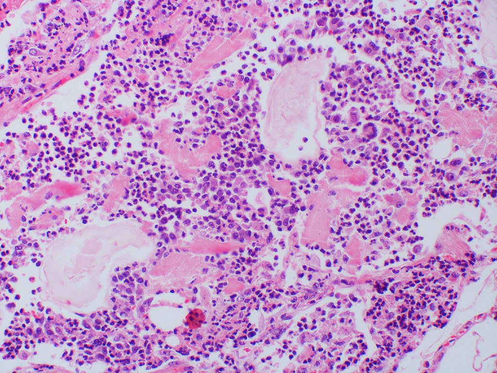 The Starch Storage System: Banking Energy for Later (image credits: flickr)