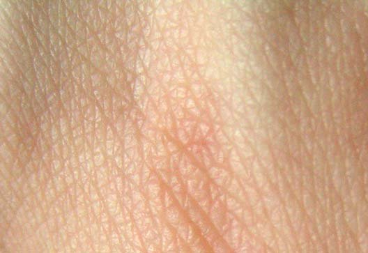 Skin's Protective Microbial Shield (image credits: wikimedia)