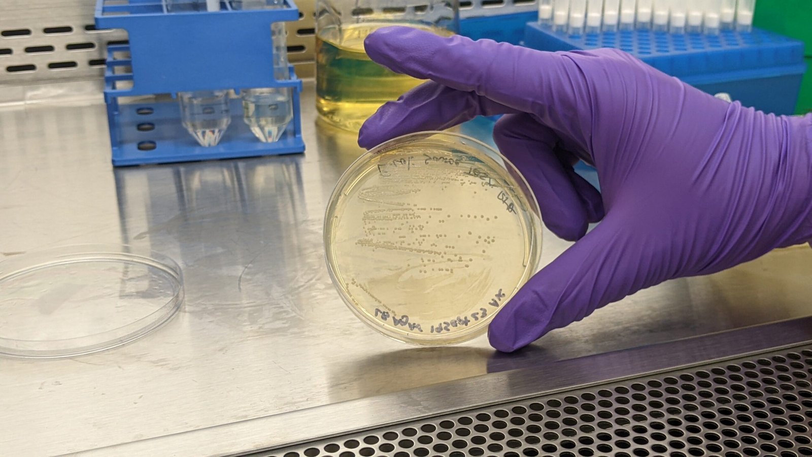 Probiotics: Reinforcing Your Microbial Army (image credits: wikimedia)