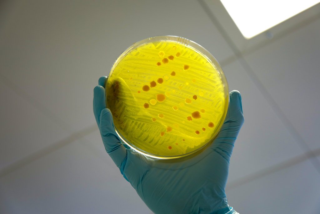 The Antibiotic Dilemma