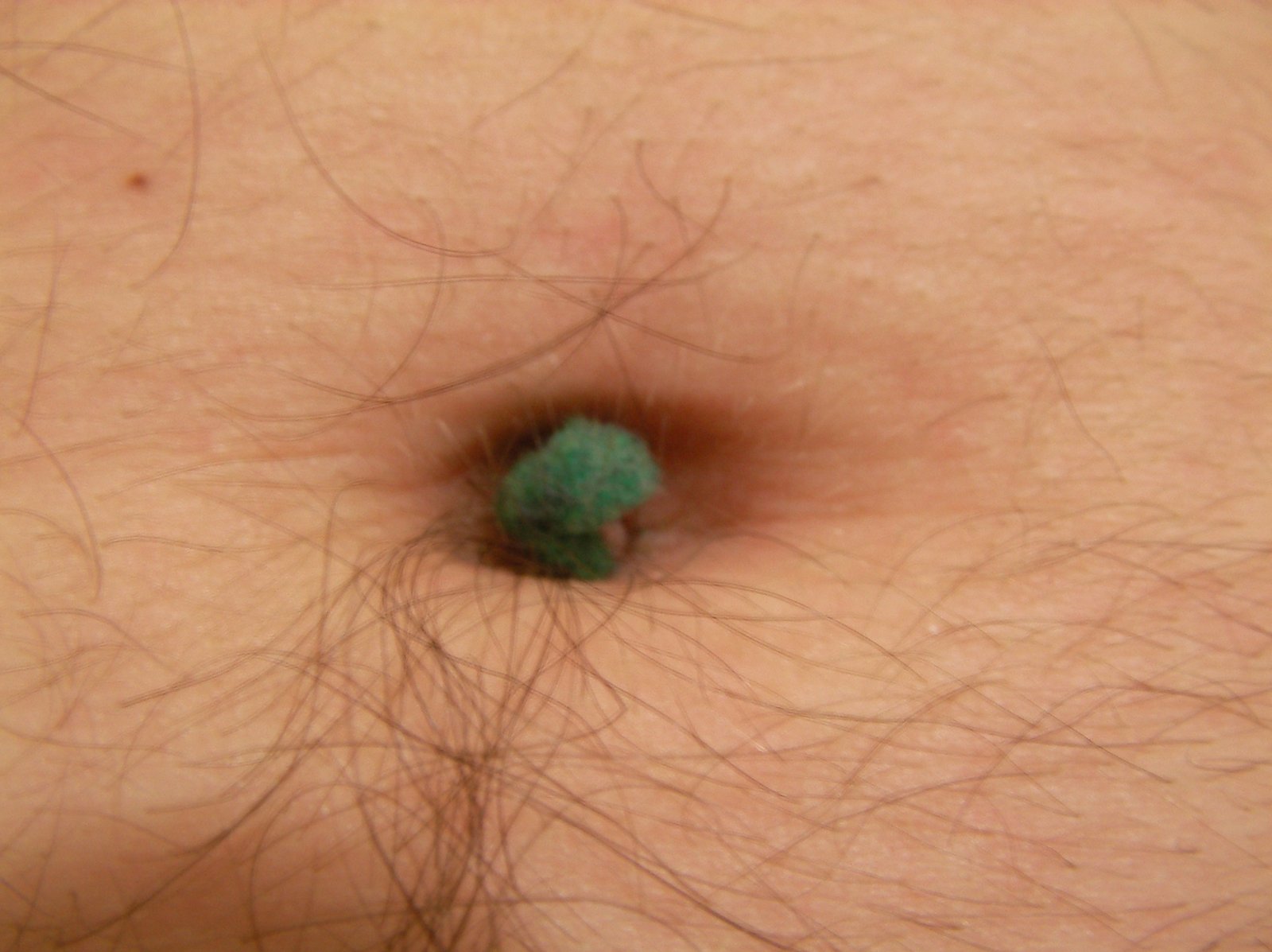 The Science of Belly Button Lint (image credits: wikimedia)