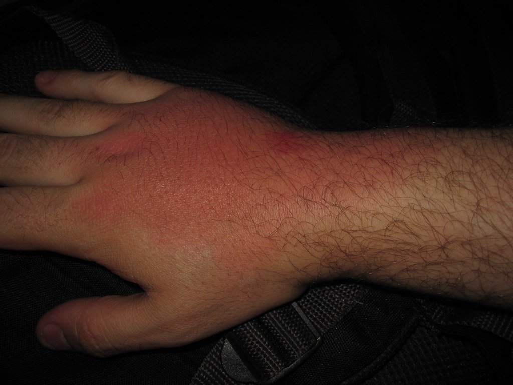 Conclusion: The Ongoing Struggle (image credits: flickr)