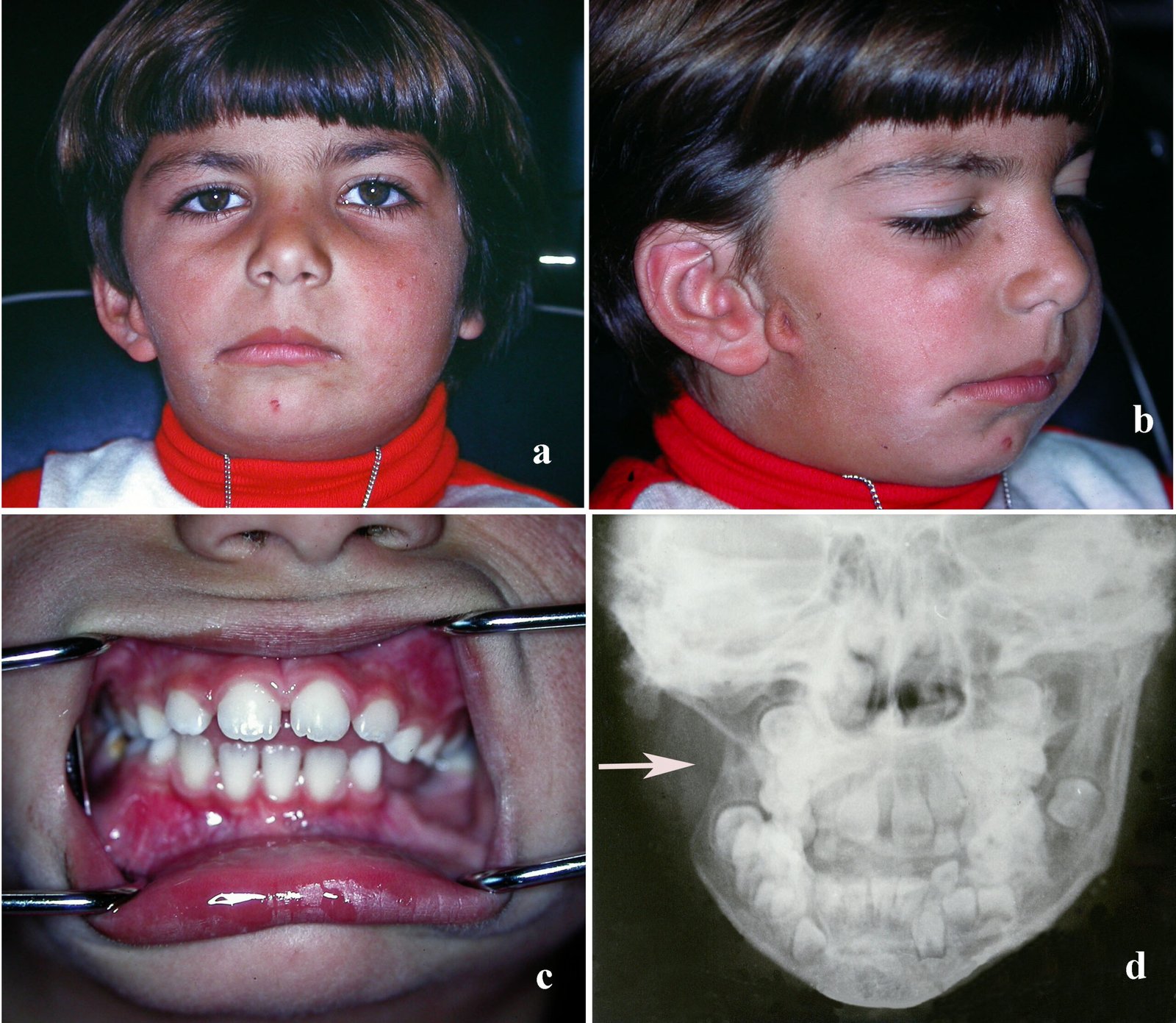 What Happens When Synchronization Fails (image credits: wikimedia)