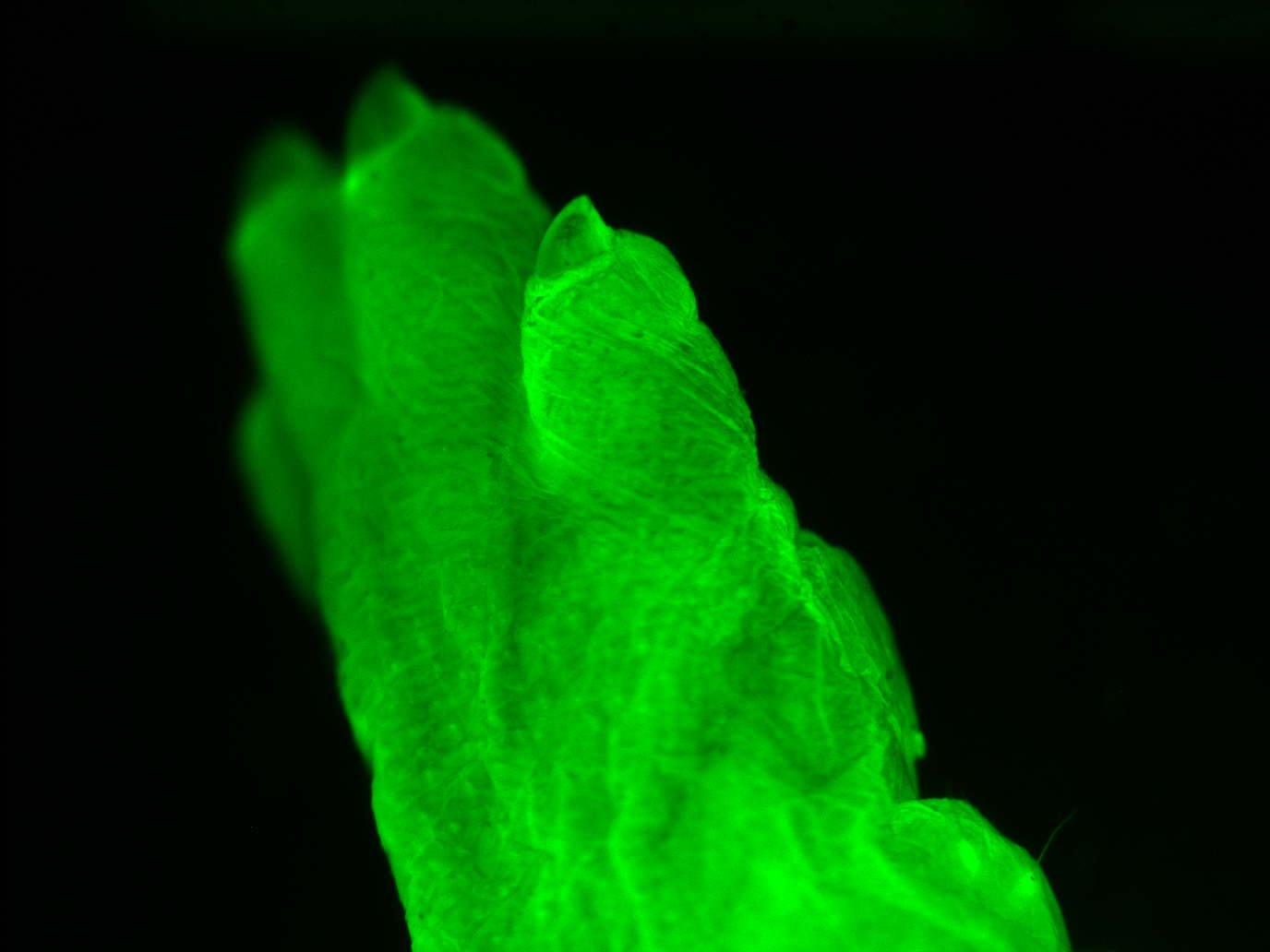 Medical Breakthroughs Made Possible by Jellyfish Protein (image credits: wikimedia)