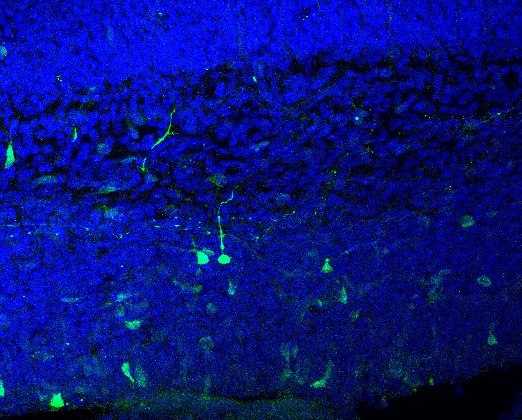 The Rainbow of Fluorescent Proteins (image credits: flickr)
