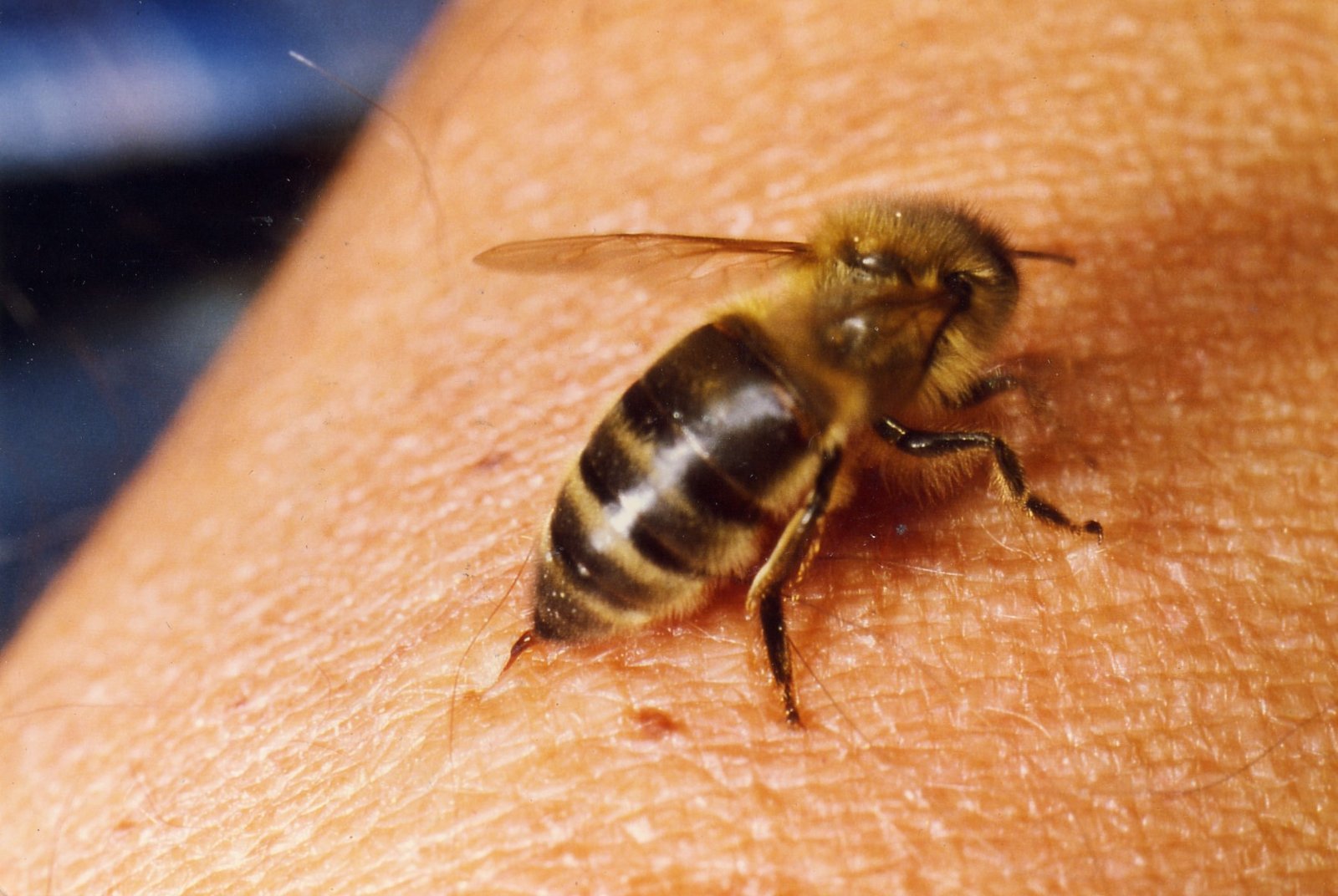 The Buzzing Architects of Medical Innovation (image credits: wikimedia)