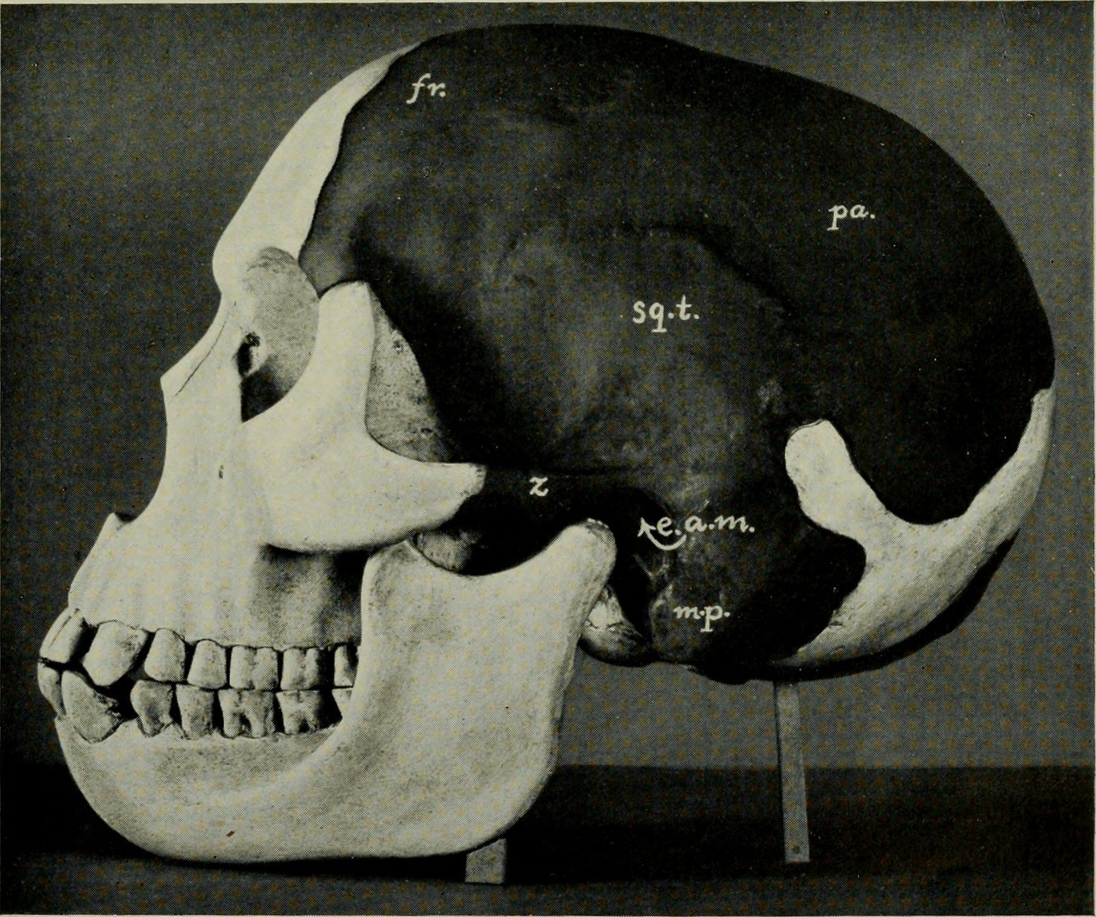 The Piltdown Man: Science's Greatest Embarrassment (image credits: wikimedia)