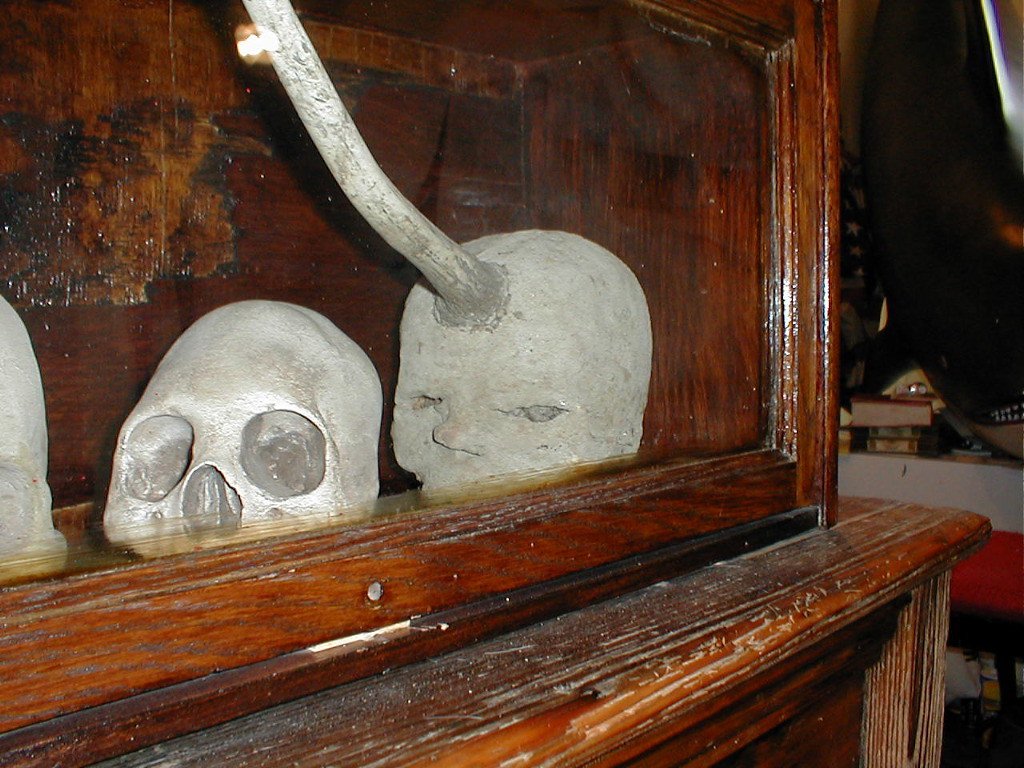 The Peruvian Masters of Skull Surgery (image credits: flickr)
