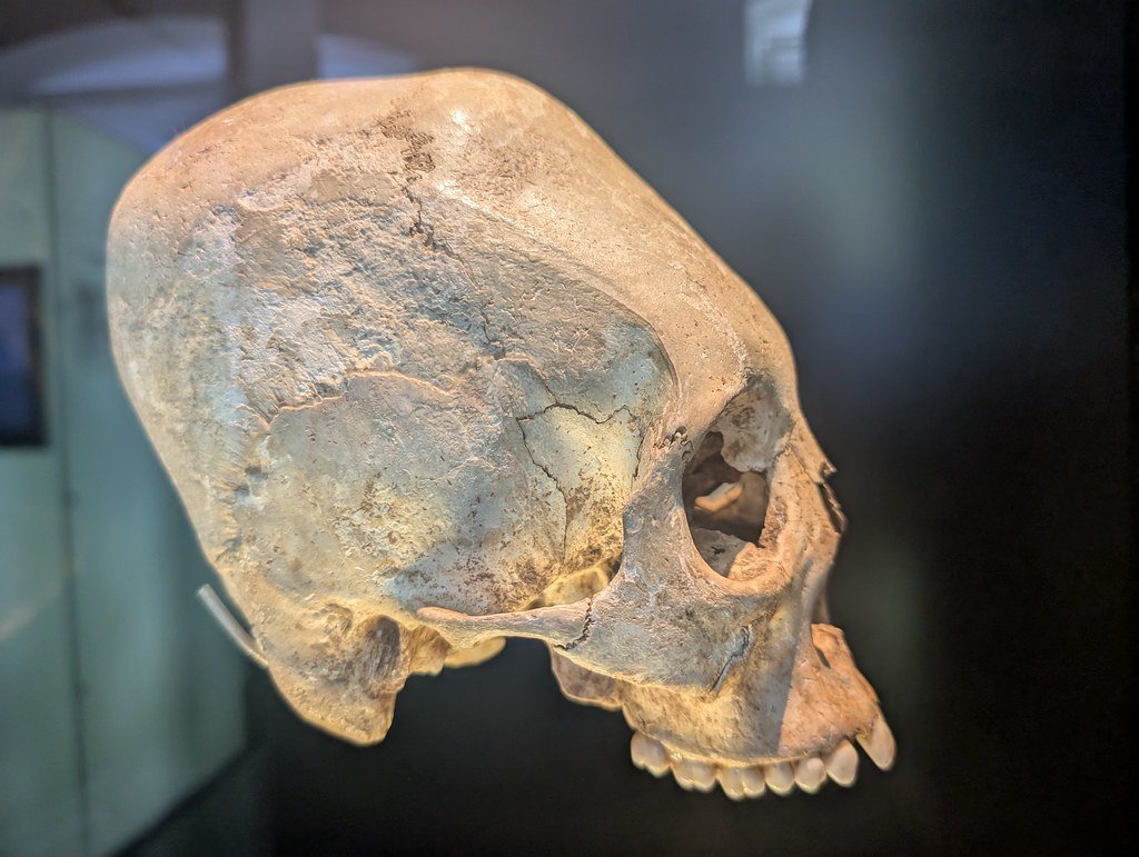 The Genetic Anomaly of the Paracas Skulls (image credits: flickr)