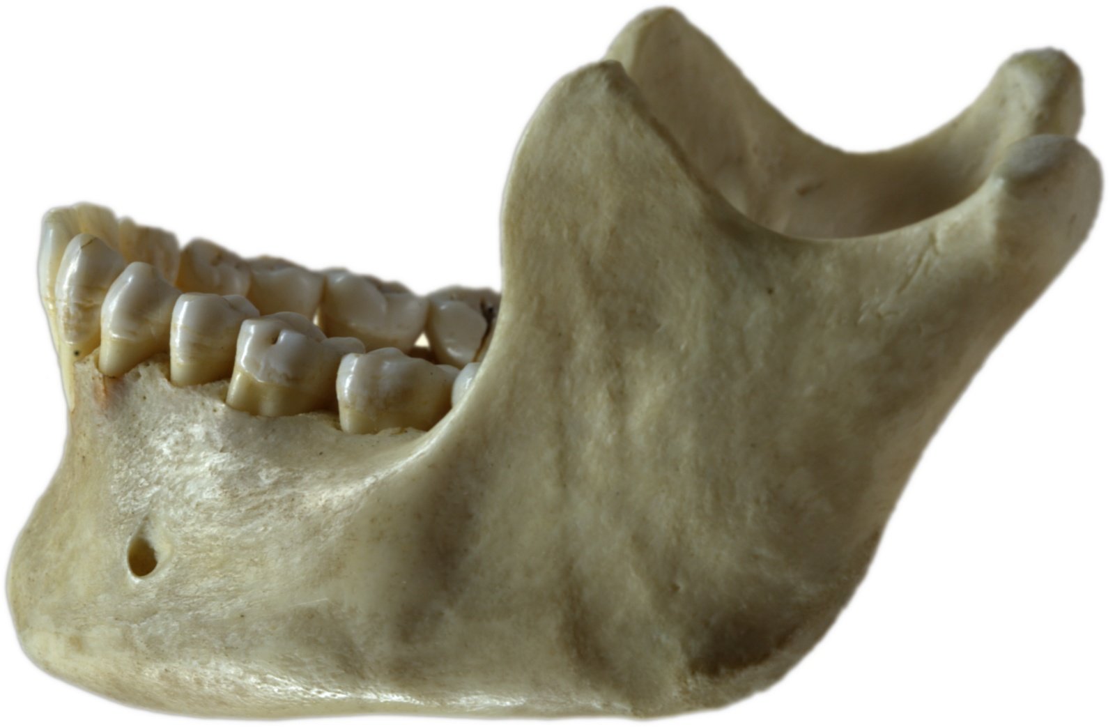 The Shrinking Human Jaw (image credits: By Gregory F. Maxwell <gmaxwell@gmail.com> PGP:0xB0413BFA, GFDL 1.2, https://commons.wikimedia.org/w/index.php?curid=766653)
