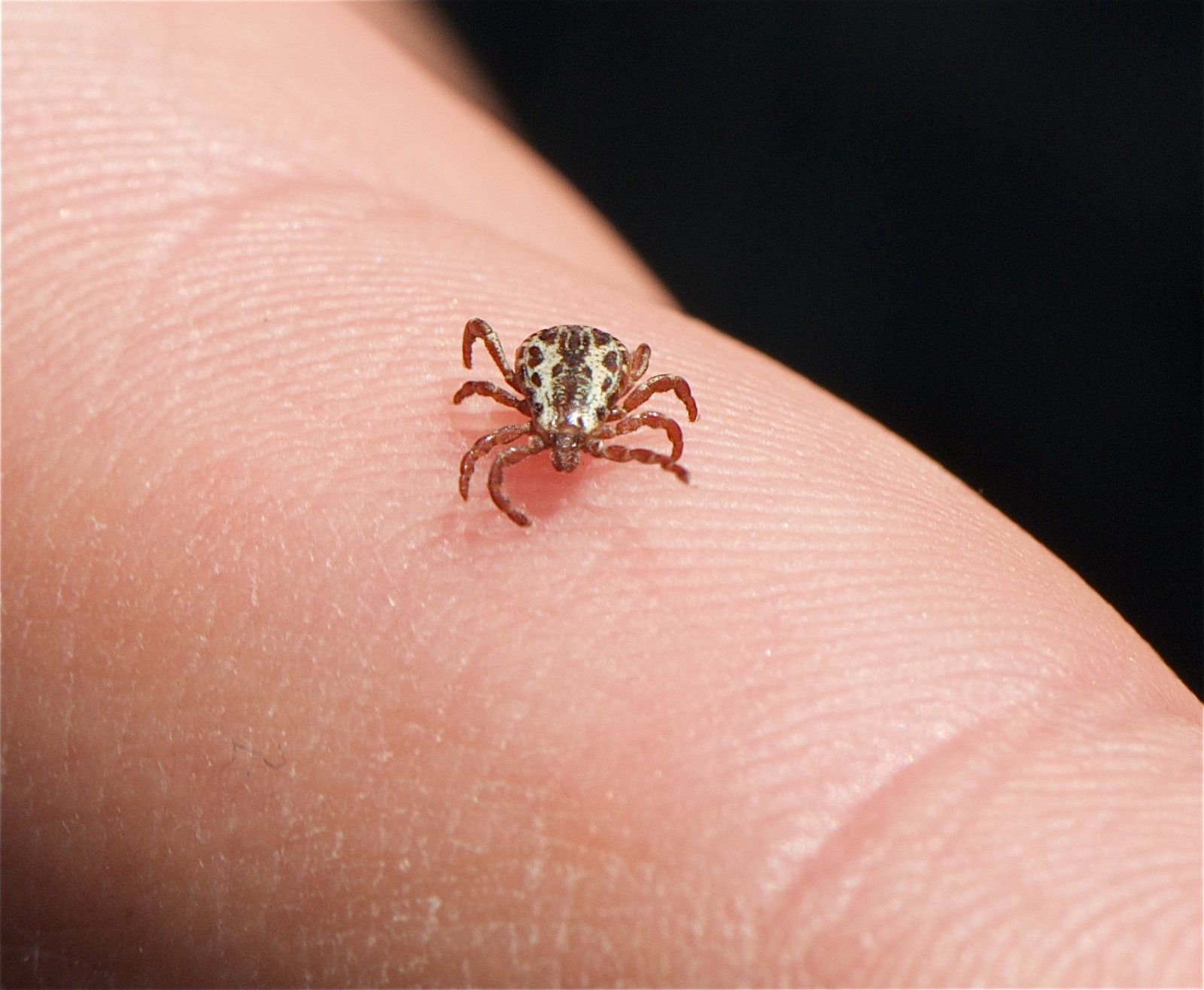 Rocky Mountain Spotted Fever: Deadly Despite Its Name (image credits: wikimedia)